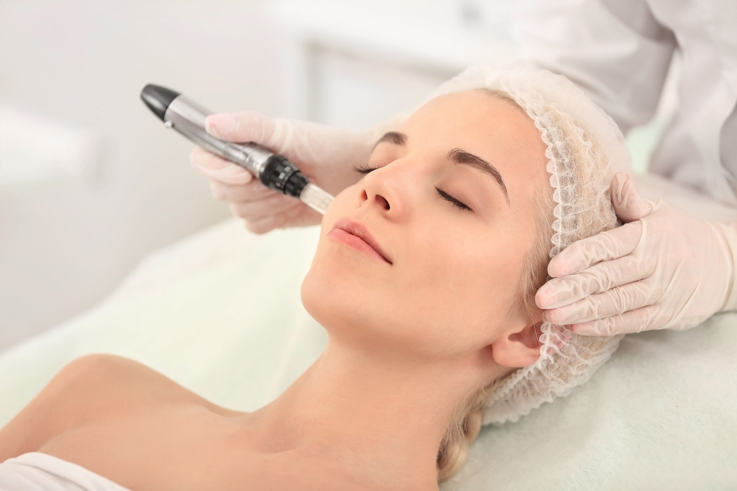Woman getting a microneedling treatment done